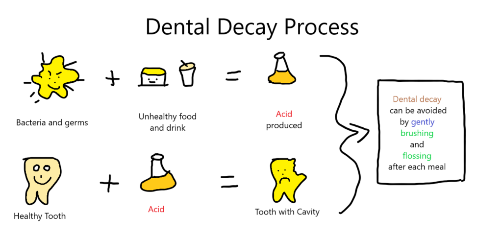Dental Decay Process